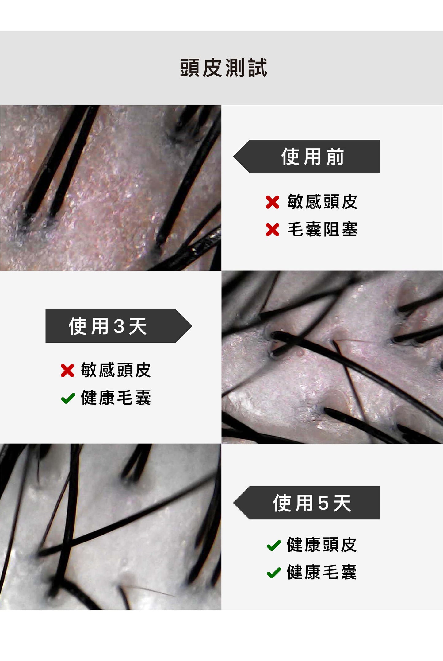 膠原蛋白洗髮精【豐盈健髮/修護護色/止癢抗屑配方】