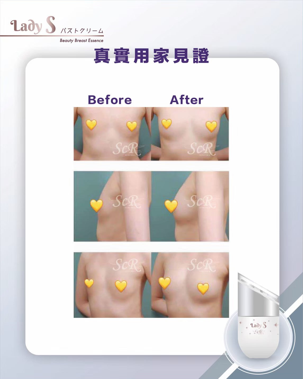 升級版LadyS豐胸乳霜 x EMS微電流&紅光導入美胸儀