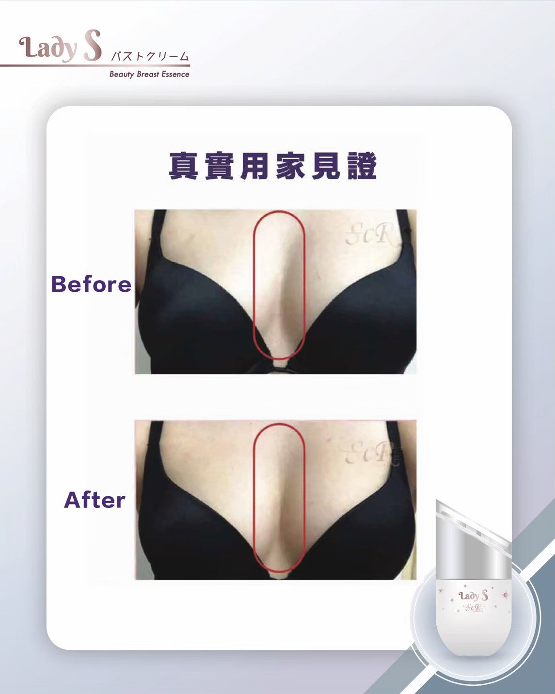 升級版LadyS豐胸乳霜 x EMS微電流&紅光導入美胸儀